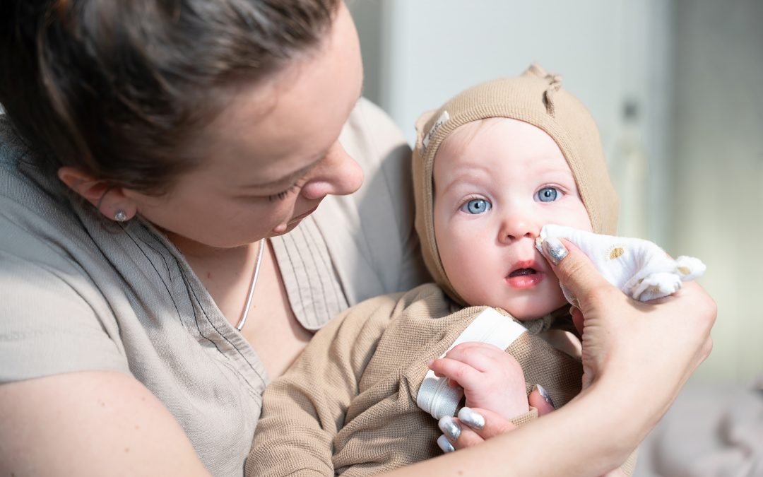 Are Babies Affected by Seasonal Allergies?